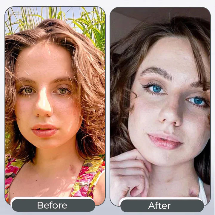 Color Change EyeDrops