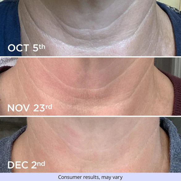 Tighten & Lifting Neck Serum