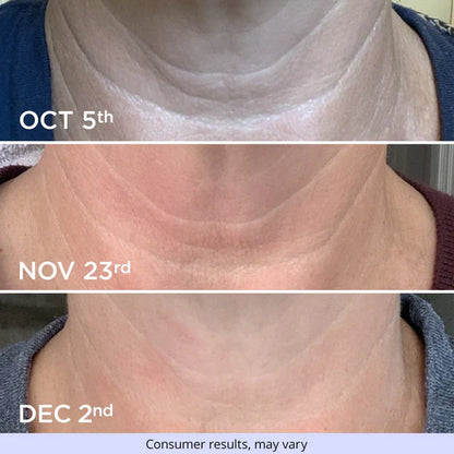 Tighten & Lifting Neck Serum